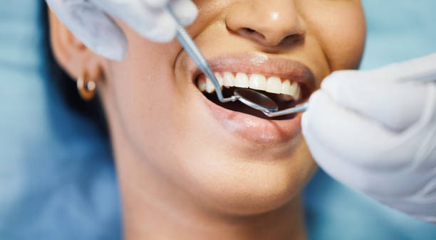 Best Emergency Dental Filling Replacement  in Mackinaw, IL