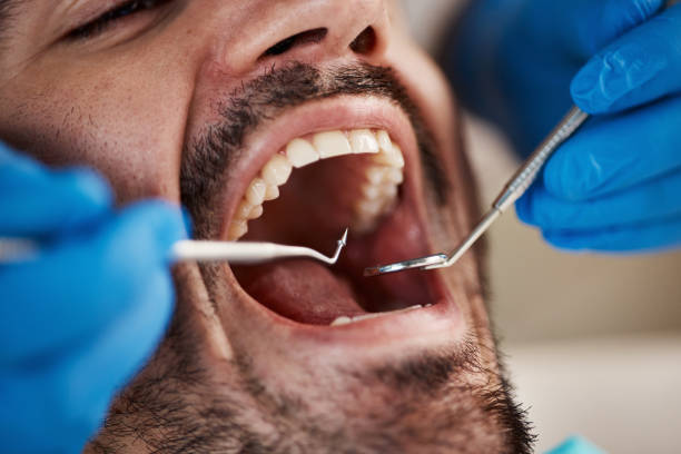 Best Emergency Dental Services Near Me  in Mackinaw, IL